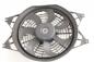 Preview: Ventilator (am Kühler) 977303E900 Kia SORENTO 1 JC